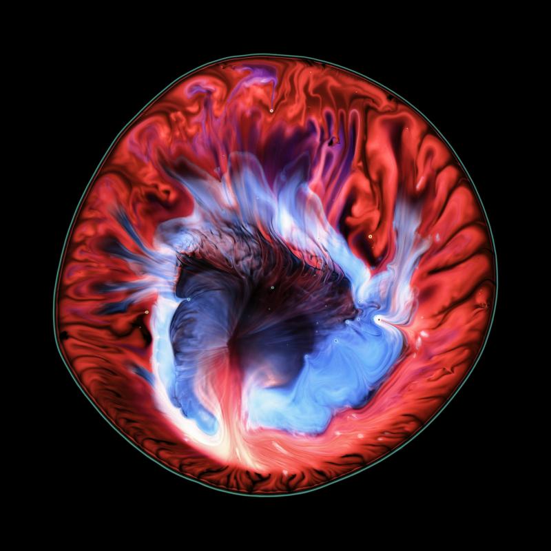 Brainstorm